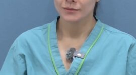 Wulan Guritno saat menjalani perawatan kulit dan operasi plastik di Korea Selatan untuk mendapatkan kulit lebih kencang dan sehat. Foto: Wolipop/Detikcom/suarabrita.com